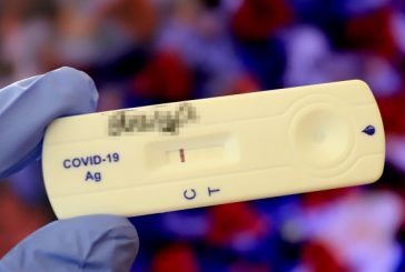Турция пуска за масова употреба нов вид тест за COVID-19 с 99% точност за 10 секунди