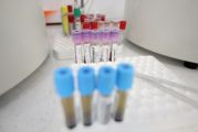 53 нови случая на коронавирус в област Благоевград, 24 в Кюстендил, 21 в Перник