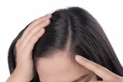 Тези симптоми предвещават оплешивяване