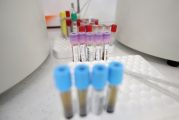 33-годишен без други заболявания почина от COVID-19