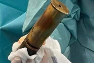 Евакуираха болница заради мъж с артилерийски снаряд в ректума