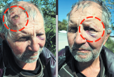 65-г. санданчанин Д. Георгиев пред „Струма”: Вярно е, че ударих снахата с брадвичка, но племенникът ми Краси и неговият син Васил ме пребиха от бой...