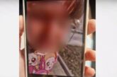 4-годишно дете пострада тежко в детска градина, на място липсвал медицински специалист