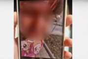 4-годишно дете пострада тежко в детска градина, на място липсвал медицински специалист